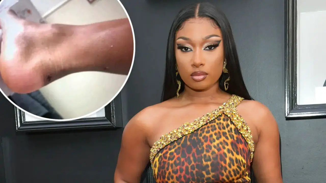Megan Thee Stallion's foot scar is the result of Tory Lanez shooting her thrice. netflixdeed.com