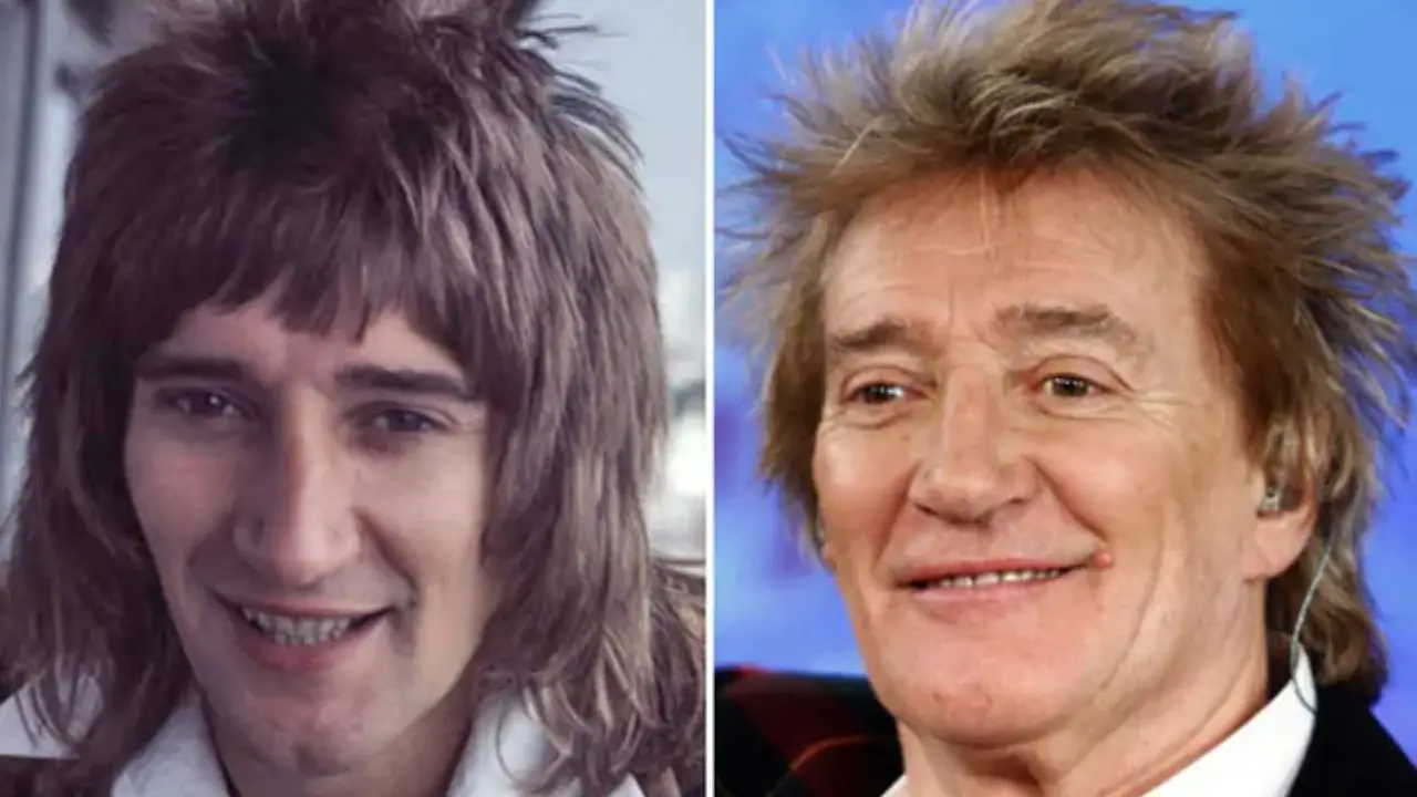 Rod Stewart before and after plastic surgery. netflixdeed.com