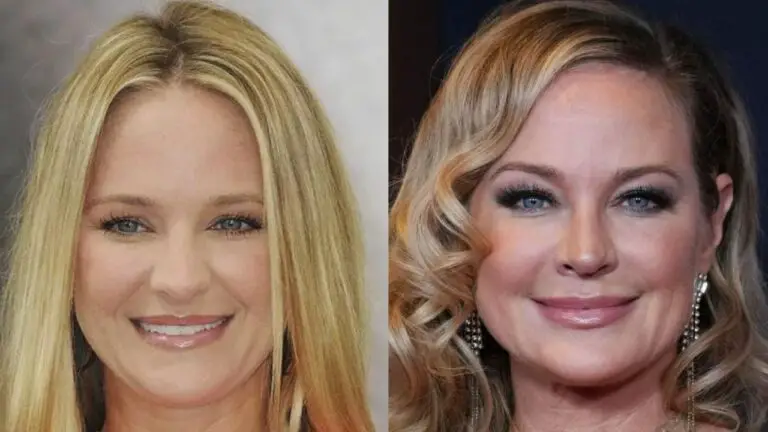 Is Sharon Case Aging Gracefully or Is It Plastic Surgery? netflixdeed.com