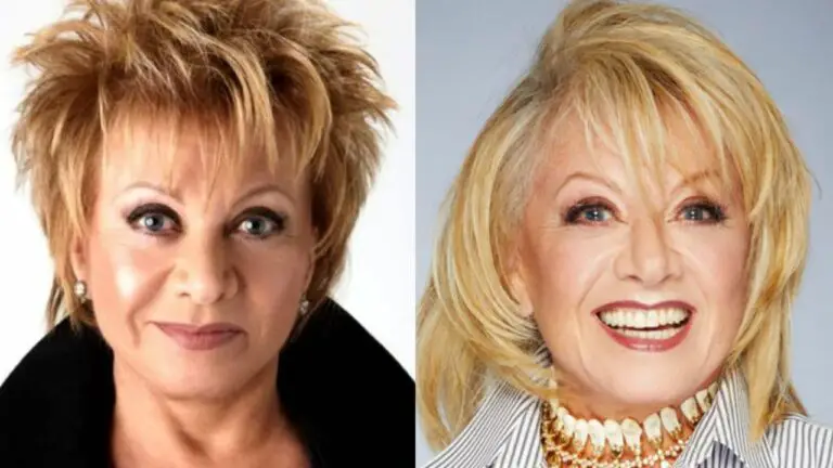 Elaine Paige’s Young Look Could Be Due to Plastic Surgery! netflixdeed.com