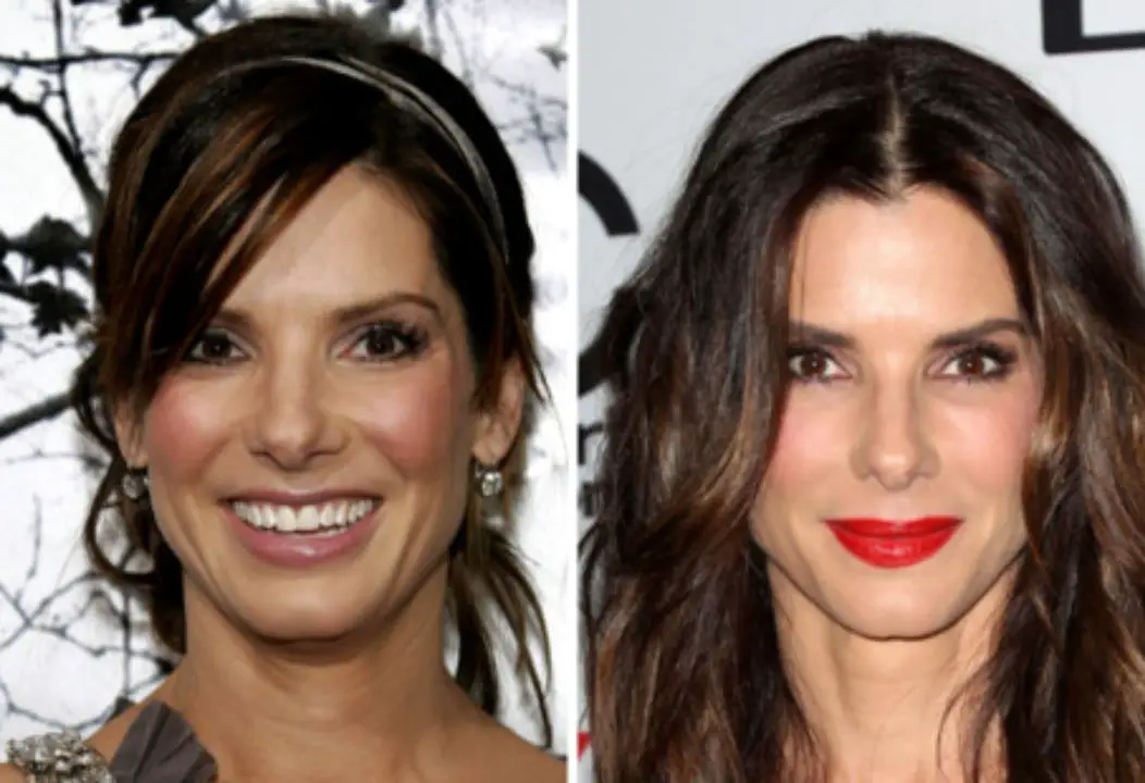 Sandra Bullock before and after plastic surgery. netflixdeed.com