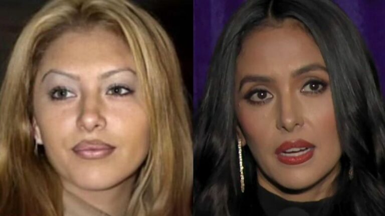 Is Vanessa Bryant’s Beauty the Result of Plastic Surgery? netflixdeed.com