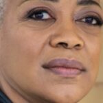 Karen Robinson’s Eyes Condition: Does the Echoes Cast Have a Garves’ Disease/Thyroid Eye Disease?