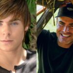 Zac Efron’s Plastic Surgery Accident: Now & Before Compared; Reddit Speculates Jaw Surgery!