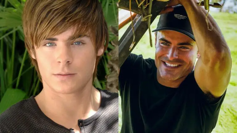 Zac Efron’s Plastic Surgery Accident: Now & Before Compared; Reddit Speculates Jaw Surgery!