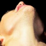 Harry Styles' Chin Scar: Taylor Swift Connection Explained! netflixdeed.com