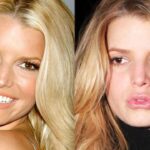 Jessica Simpson nose job lip fillers breast augmentation botox plastic surgery 2023 netflixdeed.com