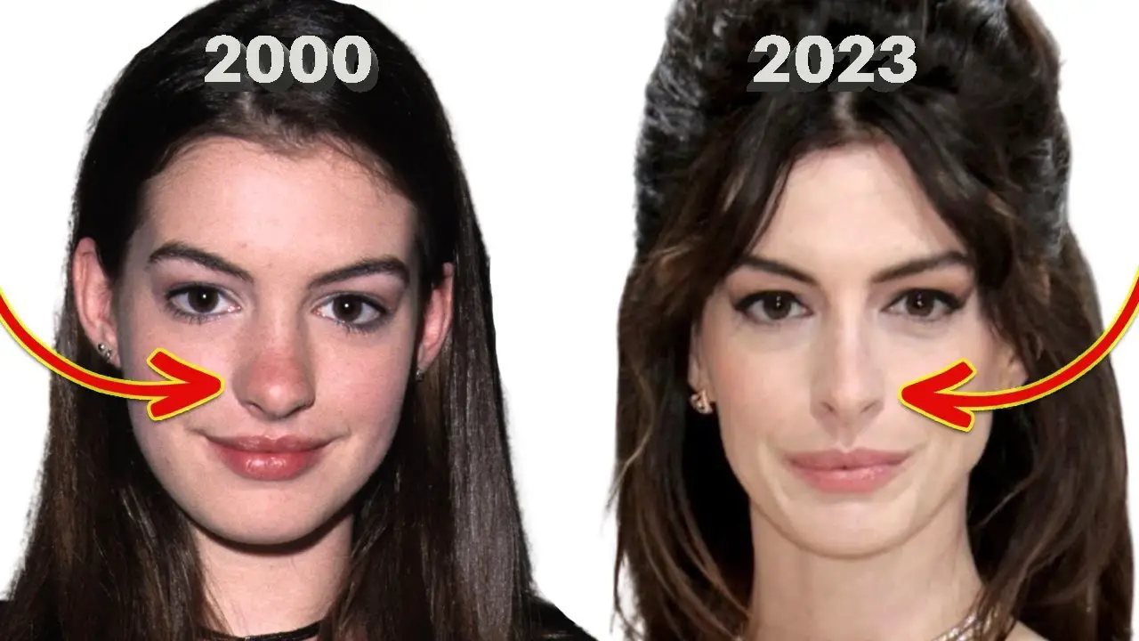 Anne Hathaway nose job netflixdeed.com