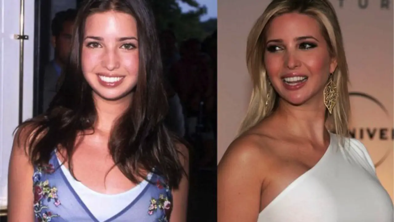 Ivanka Trump nose job 2023 netflixdeed.com