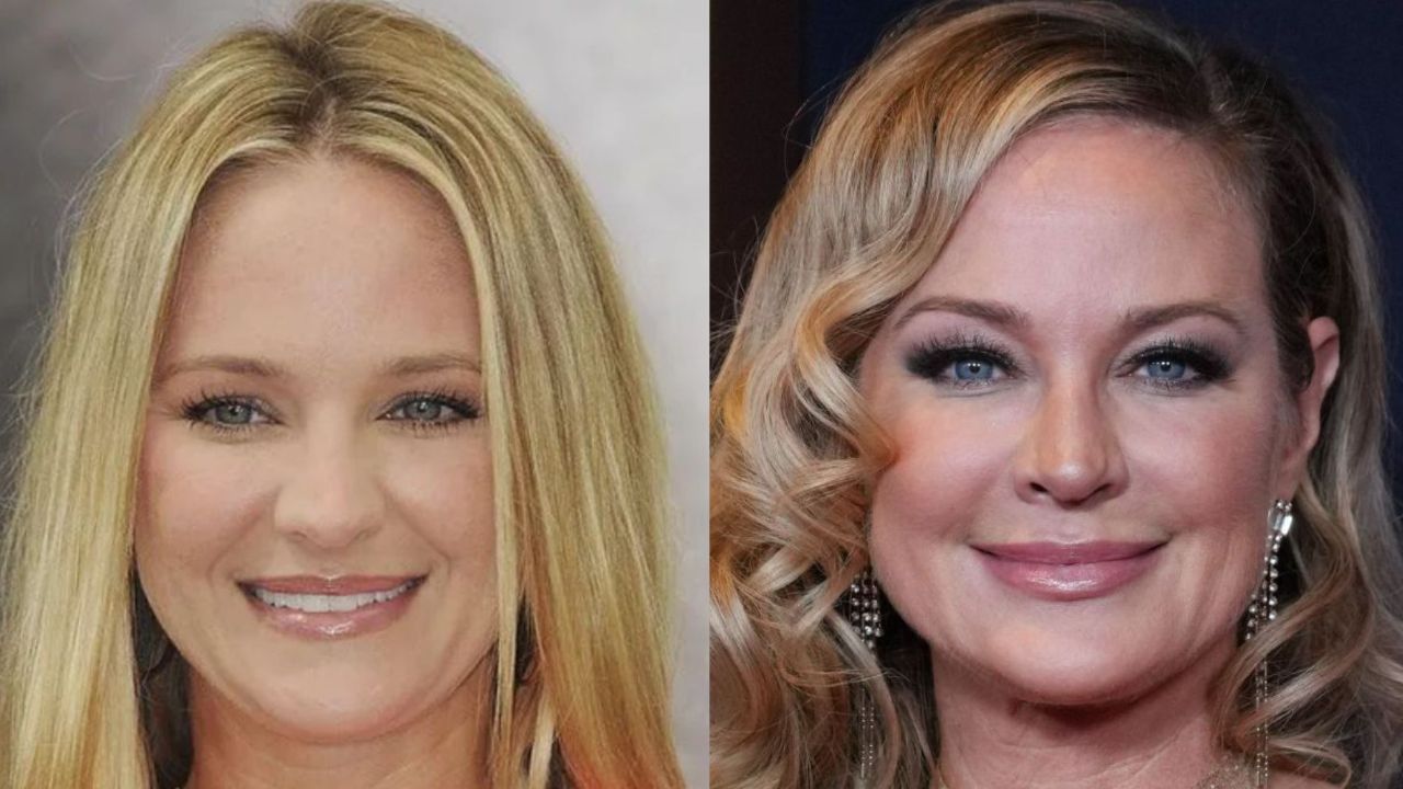 Is Sharon Case Aging Gracefully or Is It Plastic Surgery?