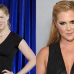 Amy Schumer’s 10-Pound Weight Gain Battle With Endometriosis