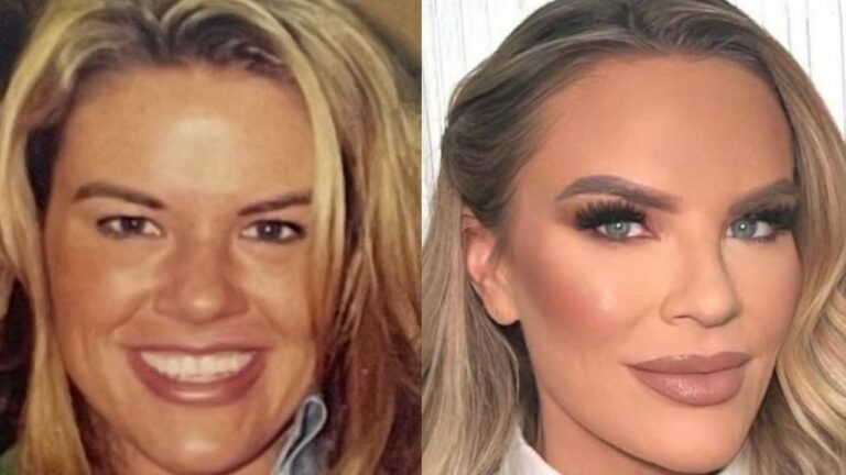 Heather Gay Plastic Surgery & Facelift Rumors: What Did She Do to Her Face? netflixdeed.com