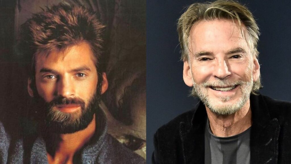kenny loggins plastic surgery Image 8