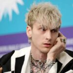 Machine Gun Kelly's Plastic Surgery Includes Hair Transplant!