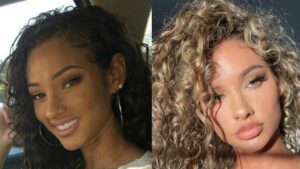 Lolo Wood’s Alleged Plastic Surgery Includes a Nose Job, Facelift & More