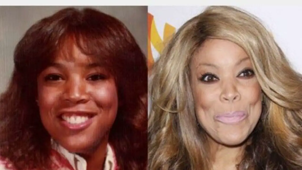 Wendy Williams before and after a nose job. netflixdeed.com
